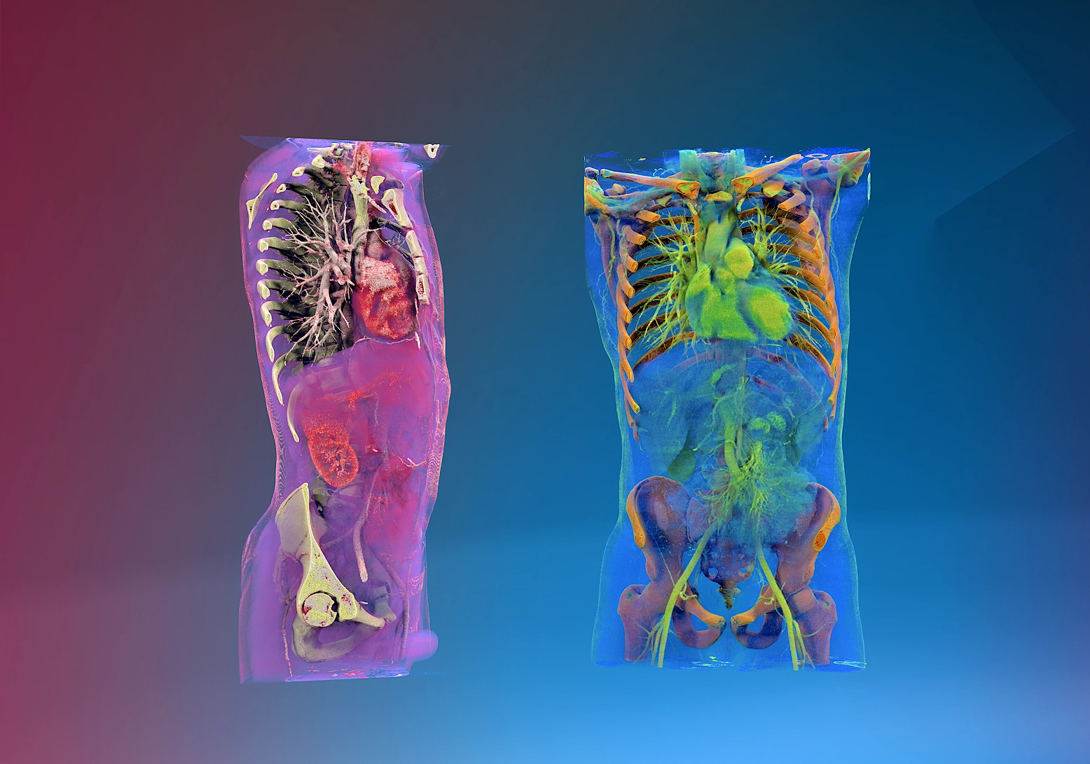 Dr Johanne AURIAUUniversity Hospital Center - Grenoble Alpes